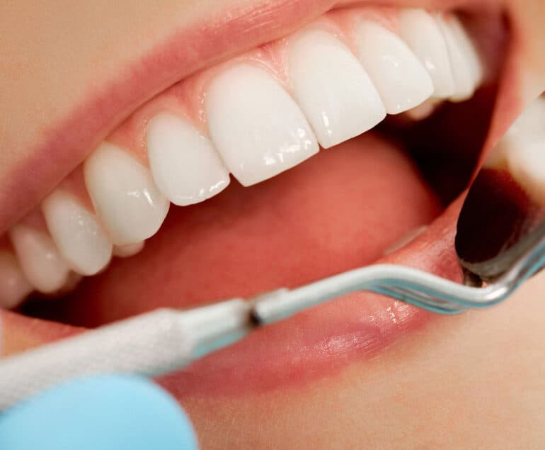Dental Consultation
