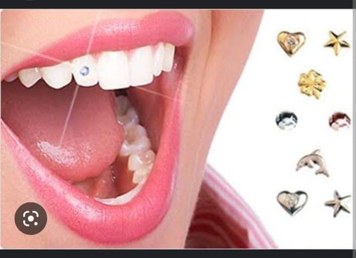 Dental Jewellery